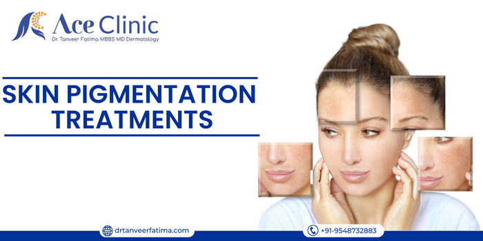 Skin Pigmentation Treatment - Suggested by Dr. Tanveer Fatima