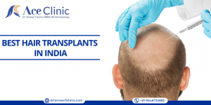 Regrow Your Hair with the Best Hair Transplant In India