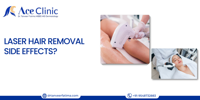 Best Laser Hair Removal Treatment in Saharanpur