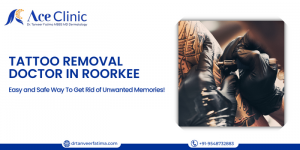 Best Tattoo Removal Doctor in Roorkee