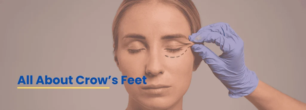 Dermatologist examining crow’s feet near the eyes – Dr. Tanveer Fatima at Ace Clinic Roorkee providing expert anti-aging treatment.