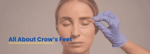 Dermatologist examining crow’s feet near the eyes – Dr. Tanveer Fatima at Ace Clinic Roorkee providing expert anti-aging treatment.
