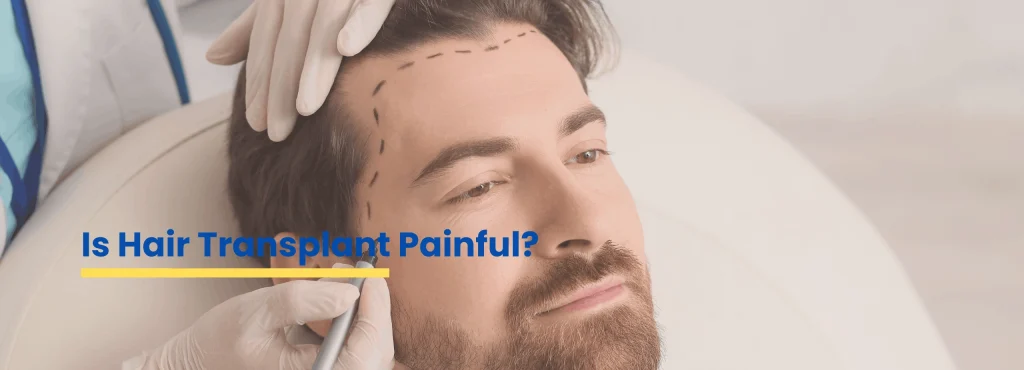 Dermatologist Dr Tanveer Fatima explaining whether hair transplant is painful and how FUE hair transplant is performed at ACE Clinic