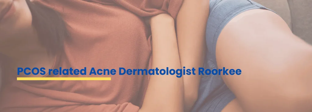 PCOS related acne dermatologist Roorkee Dr Tanveer Fatima providing hormonal acne treatment at ACE Clinic Roorkee.