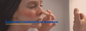 Rosacea symptoms on face and expert rosacea treatment in Roorkee by dermatologist
