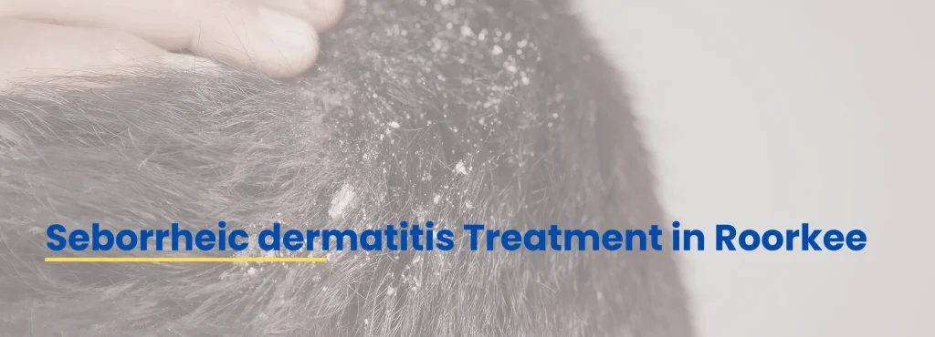 Seborrheic dermatitis treatment in Roorkee by Dr. Tanveer Fatima at ACE Clinic Roorkee for itchy, flaky scalp care