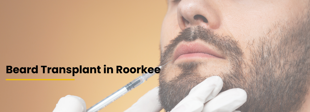 Patient consultation and beard transplant planning by Dr. Tanveer Fatima at Ace Skin & Hair Clinic, Roorkee for natural-looking beard restoration and facial hair transplant treatment.