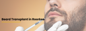 Patient consultation and beard transplant planning by Dr. Tanveer Fatima at Ace Skin & Hair Clinic, Roorkee for natural-looking beard restoration and facial hair transplant treatment.