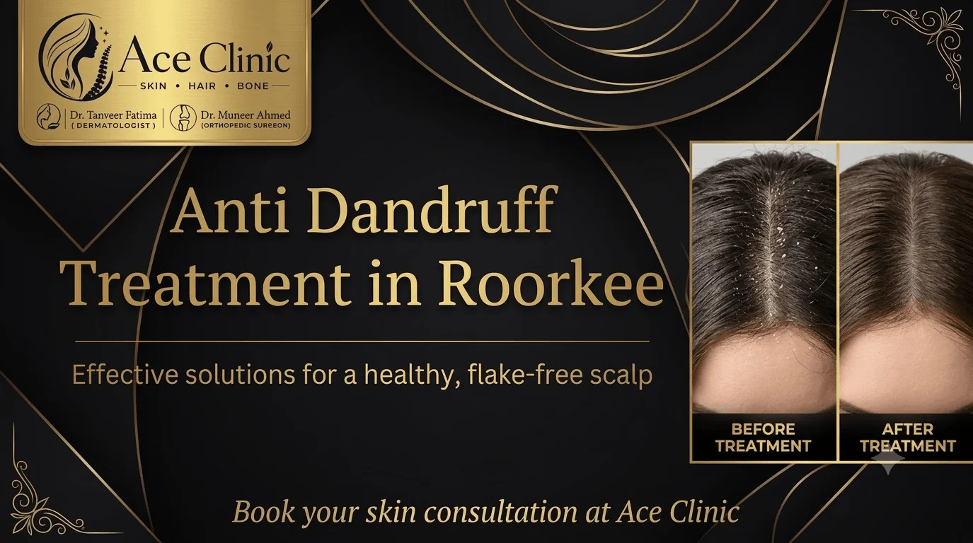 Anti dandruff treatment in Roorkee by Dr Tanveer Fatima at Ace Skin and Hair Clinic