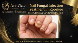 Nail fungal infection treatment in Roorkee by Dr Tanveer Fatima at Ace Skin and Hair Clinic